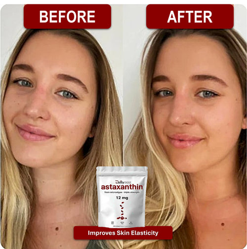 Daily Dose Astaxanthin