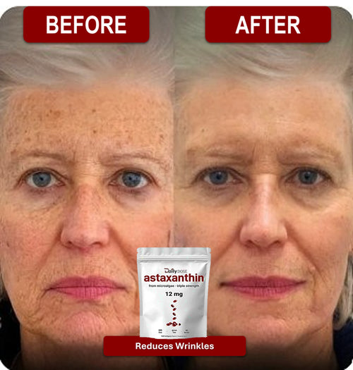 Daily Dose Astaxanthin