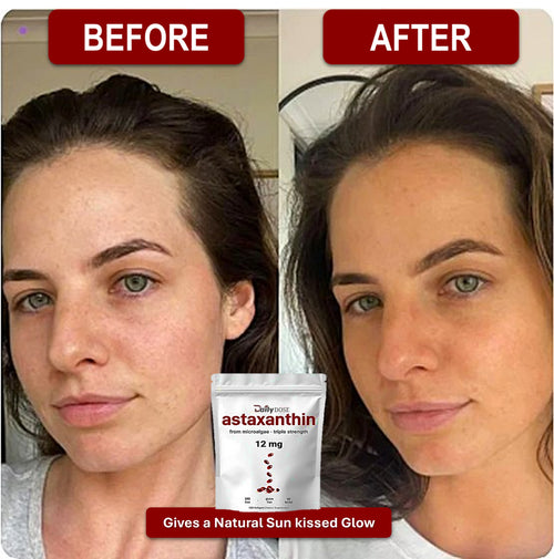 Daily Dose Astaxanthin